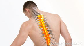 McHenry thoracic spine pain image 