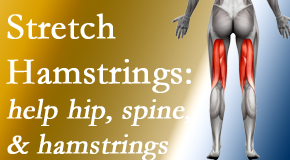 OrthoIllinois Chiropractic promotes back pain patients to stretch hamstrings for length, range of motion and flexibility to support the spine.