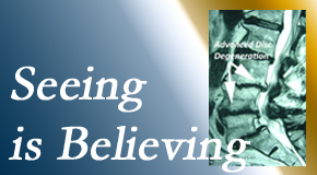 OrthoIllinois Chiropractic understands how “seeing [imaging – xray or MRI] is believing” works for back pain patients to see the cause of their pain. 