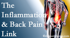 OrthoIllinois Chiropractic tackles the inflammatory process that accompanies back pain as well as the pain itself.
