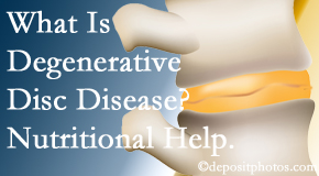 OrthoIllinois Chiropractic treats degenerative disc disease with chiropractic treatment and nutritional interventions. 