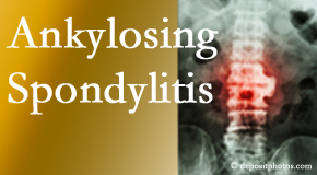 Ankylosing spondylitis is gently cared for by your McHenry chiropractor.