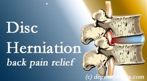 OrthoIllinois Chiropractic offers non-surgical treatment for relief of disc herniation related back pain. 
