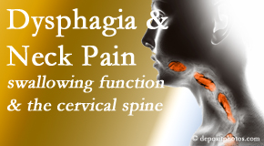 <p />Many McHenry [[cervical spine-related pain (like <a href=