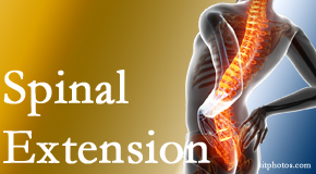 OrthoIllinois Chiropractic knows the role of extension in spinal motion, its necessity, its benefits and potential harmful effects. 