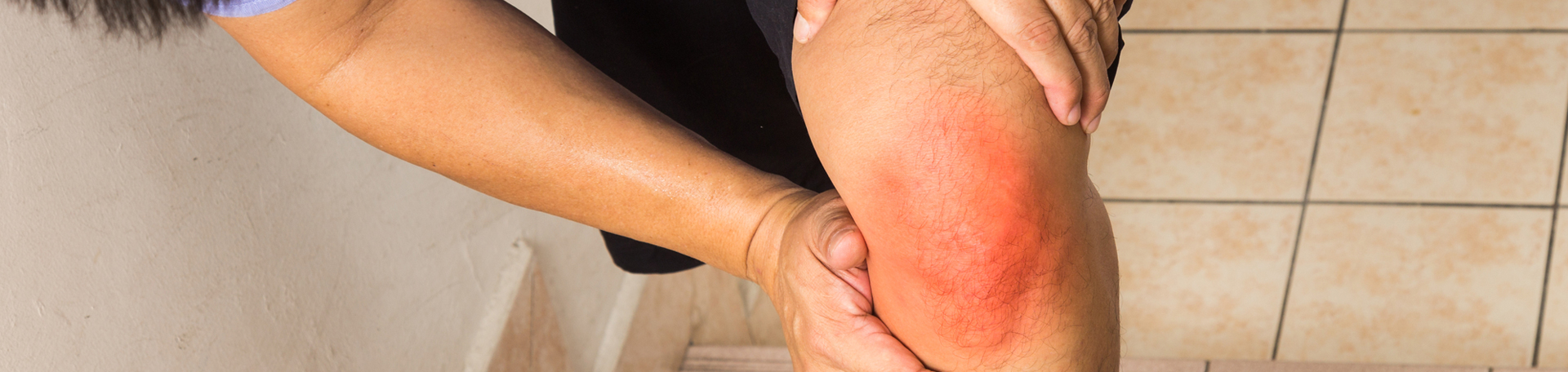 McHenry knee pain, osteoarthritis