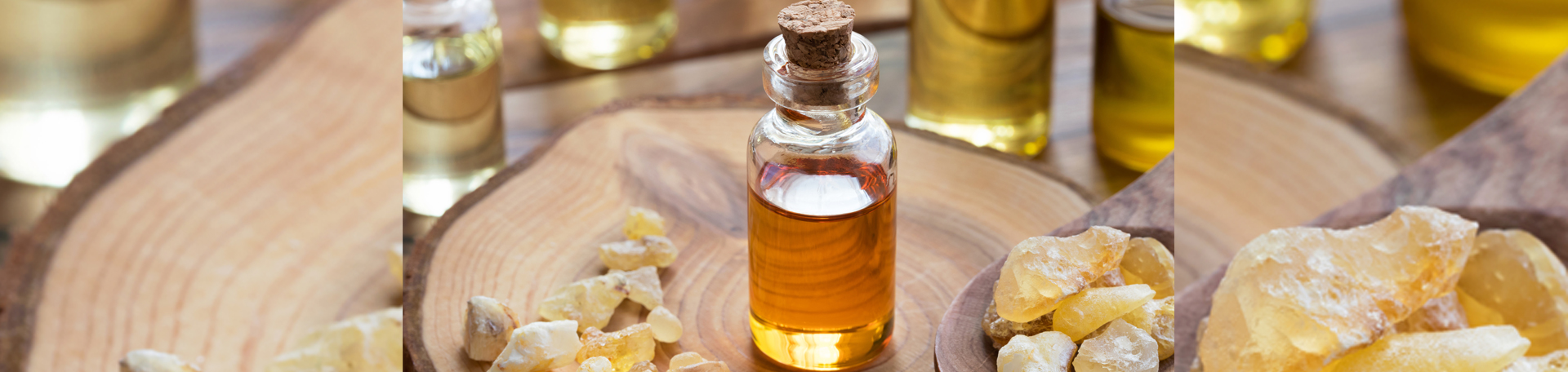 McHenry anti-inflammatory frankincense