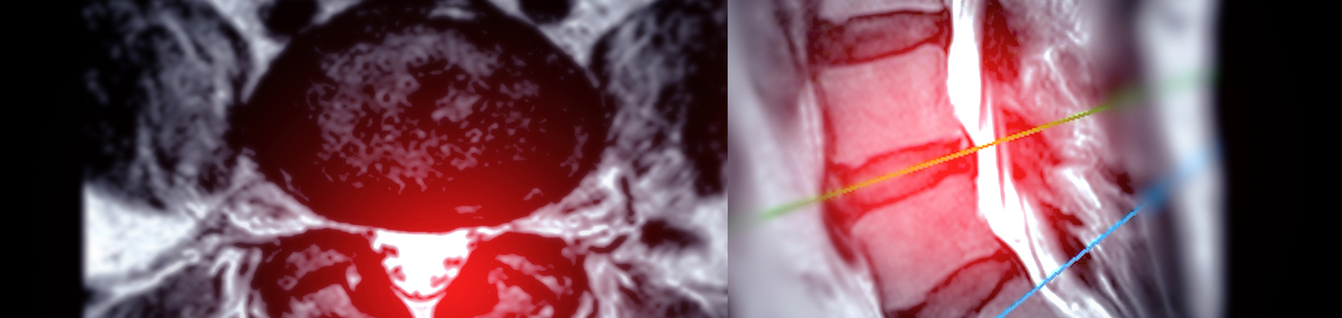 McHenry back pain imaging and exercise