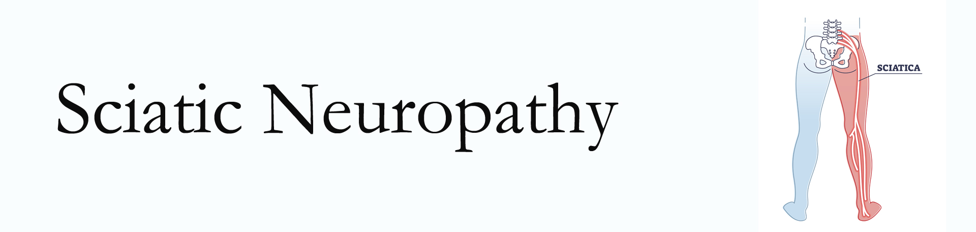 McHenry neuropathy pain (sciatica)