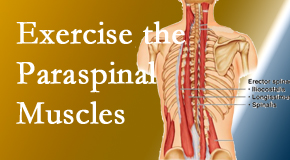 OrthoIllinois Chiropractic explains the importance of paraspinal muscles and their strength for McHenry back pain relief.