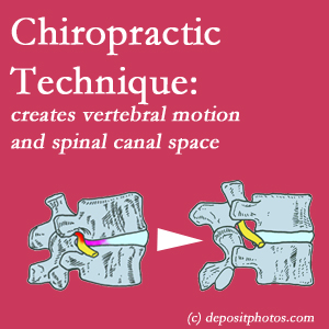 image of a McHenry spinal stenotic canal