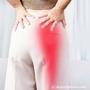 image of McHenry leg pain, sciatica, lumbar radiculopathy