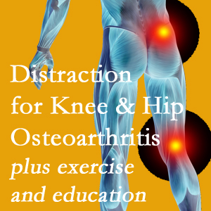 A chiropractic treatment plan for McHenry knee pain and hip pain caused by osteoarthritis: education, exercise, distraction.