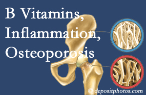 McHenry chiropractic care of osteoporosis usually comes with nutritional tips like b vitamins for inflammation reduction and for prevention.