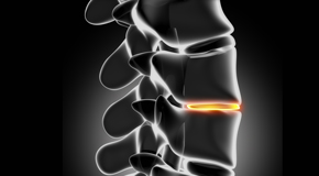 McHenry chiropractic nutrition with vitamin D and quercitrin