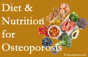McHenry osteoporosis prevention tips from your chiropractor include improved diet and nutrition and reduced sodium, bad fats, and sugar intake. 
