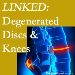 Degenerated discs and degenerated knees are not such strange bedfellows. They are seen to be related. McHenry patients with a loss of disc height due to disc degeneration often also have knee pain related to degeneration.  