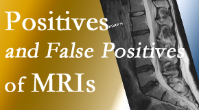 OrthoIllinois Chiropractic carefully chooses when and if MRI images are needed to guide the McHenry chiropractic treatment plan. 