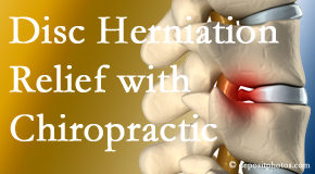 OrthoIllinois Chiropractic gently treats the disc herniation causing back pain. 